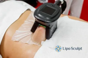 Cryolipolysis Helping You Getting that Perfect Summer Body 3 Cryolipolysis Eastbourne can give you the best summer body - contact us today!