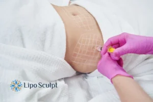 Are The Results From Aqualyx Permanent? 1 Do you want to know how long Aqualyx Eastbourne results last?