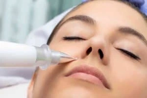 Best Actinic Keratoses Removal 3 Actinic keratoses Eastbourne solutions - book in today!